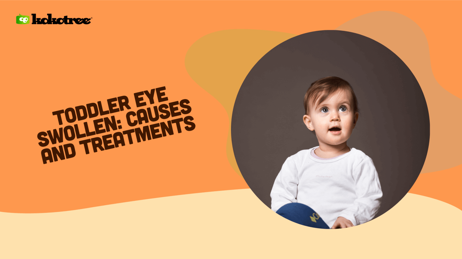 Toddler Eye Swollen Causes and Treatments Kokotree